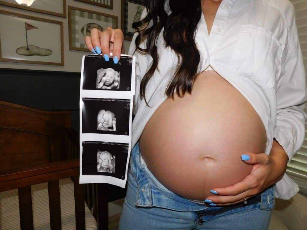 Photo Gallery - Beach Bump Imaging - Bradenton/Sarasota Elective 3D 4D ...