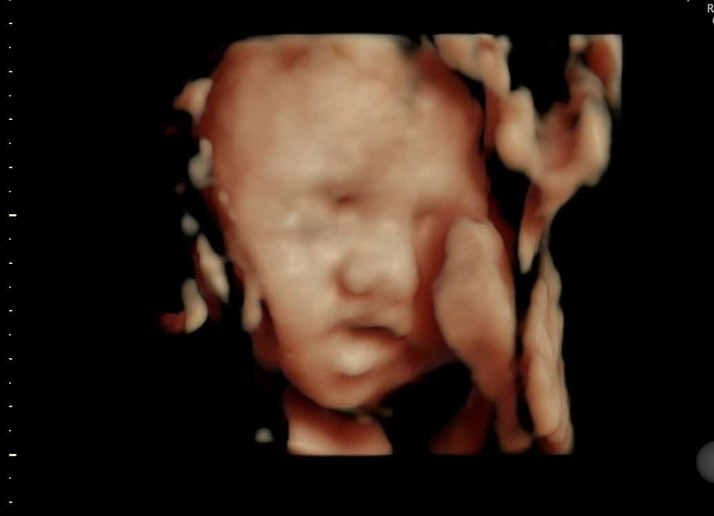 Studio - Beach Bump Imaging - Bradenton/Sarasota Elective 3D 4D Ultrasound