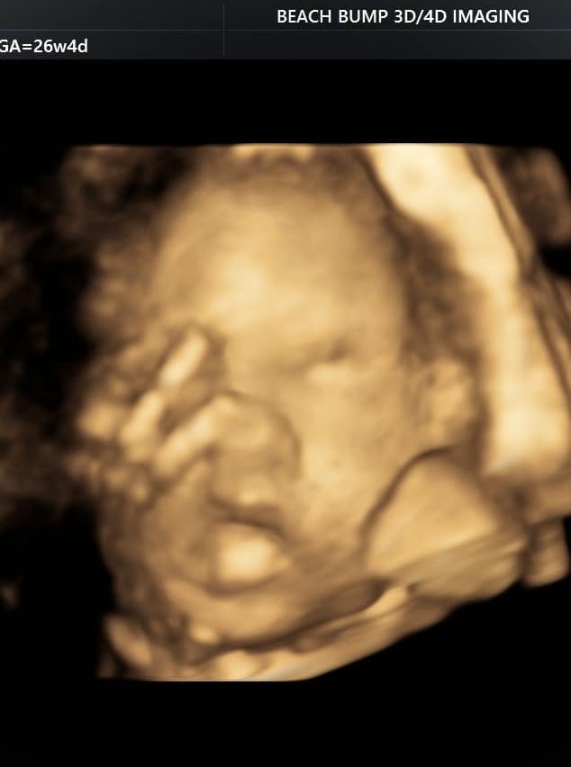 Studio - Beach Bump Imaging - Bradenton/Sarasota Elective 3D 4D Ultrasound